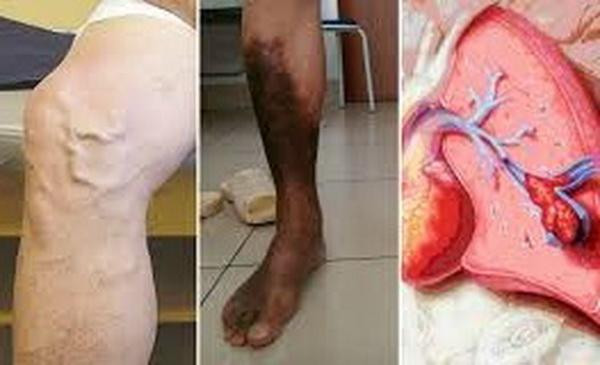 Tác động mạch chi