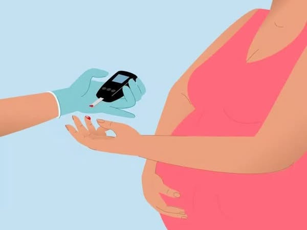 Thử đường huyết thai kỳ - Ảnh minh họa BVCC