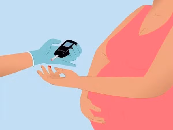 Thử đường huyết thai kỳ - Ảnh minh họa BVCC