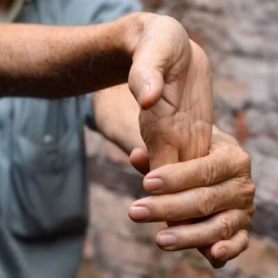 Mở rộng cổ tay - Ảnh BVCC Mở rộng cổ tay - Ảnh BVCC