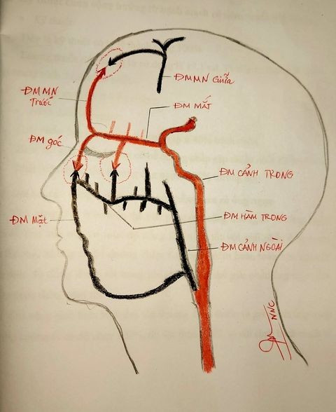 Ảnh minh họa cơ chế filer gây mù mắt - Ảnh BSCC