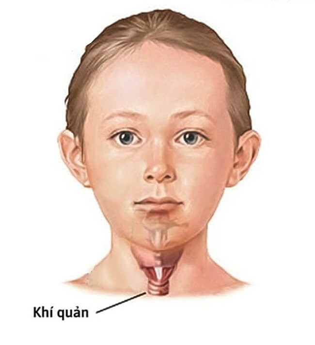 Khí quản là một trong những bộ phận vô cùng quan trọng của hệ hô hấp