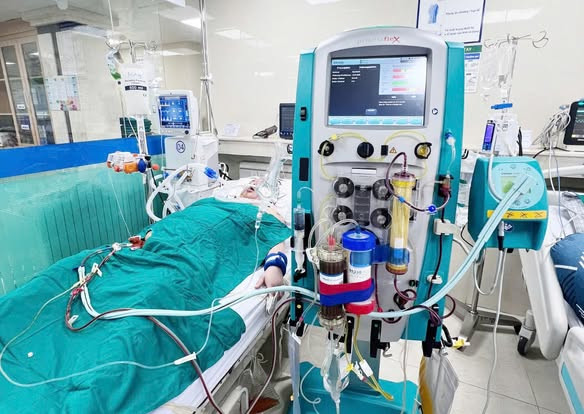 Người bệnh bị suy gan cấp do ngộ độc paracetamol được hồi sức bằng phương pháp lọc máu hấp phụ phân tử kép (DPMAS) - Ảnh BVCC