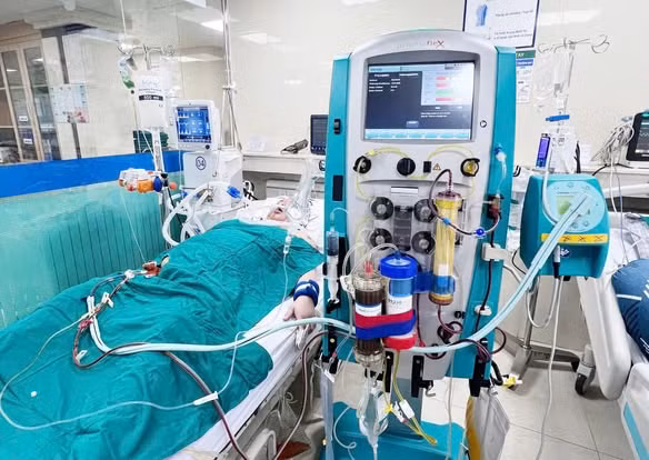 Người bệnh bị suy gan cấp do ngộ độc paracetamol được hồi sức bằng phương pháp lọc máu hấp phụ phân tử kép (DPMAS) - Ảnh BVCC