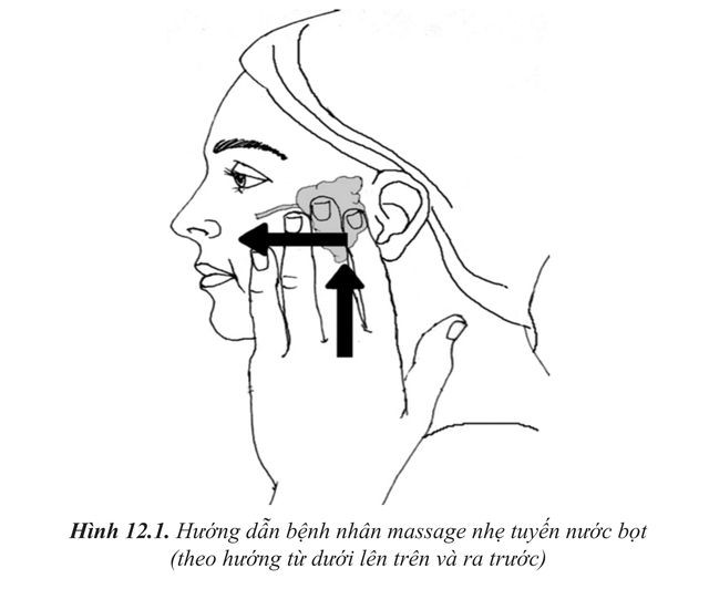 Cách khắc phục viêm tuyến nước bọt khi điều trị ung thư tuyến giáp ảnh 1