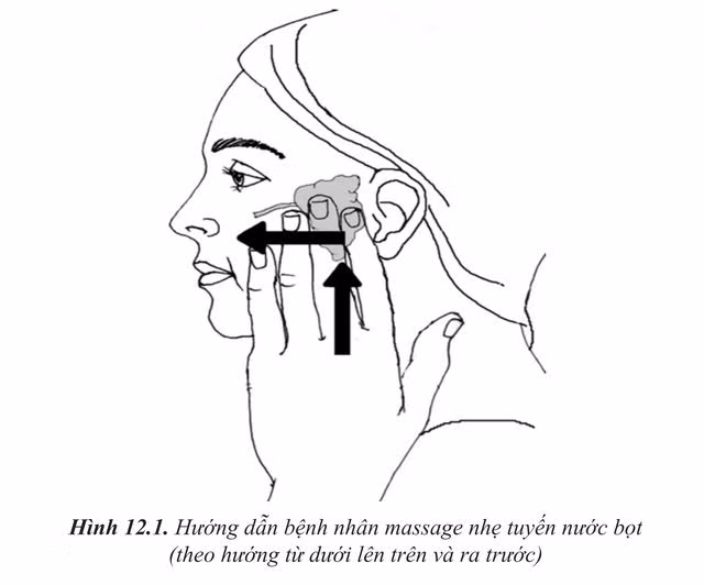 Cách khắc phục viêm tuyến nước bọt khi điều trị ung thư tuyến giáp ảnh 1 Cách khắc phục viêm tuyến nước bọt khi điều trị ung thư tuyến giáp ảnh 1