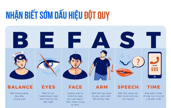 Dấu hiệu đột quỵ - Ảnh minh họa BSCC
