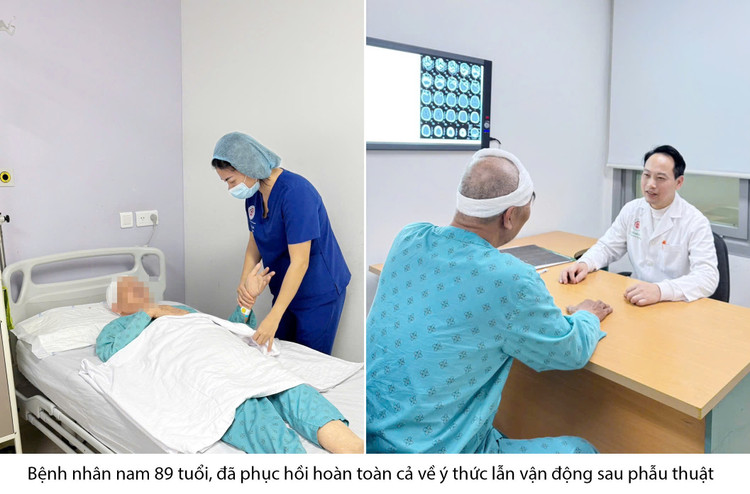 Cảnh giác người già ngã lâu mới phát hiện chấn thương sọ não - Ảnh BVCC