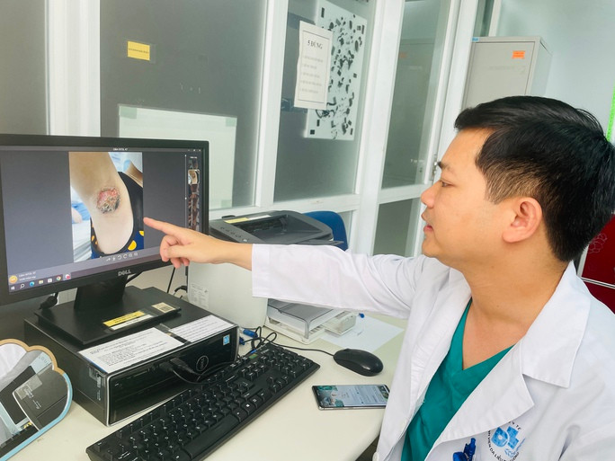 BS Nguyễn Đình Quân cho biết tổn thương vùng nách có thể để lại hậu quả nghiêm trọng