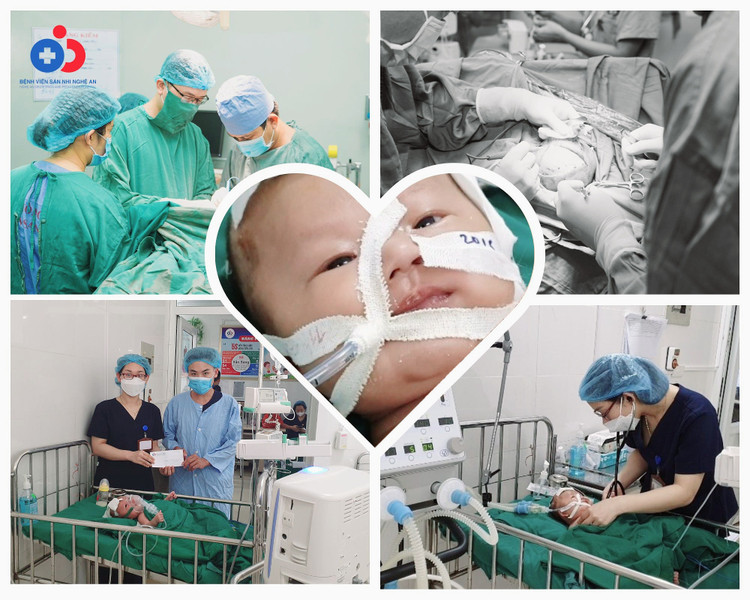 26 ngày tuổi đã xuất huyết não: Bệnh viện thuyết phục bố mẹ để cứu trẻ ảnh 1 26 ngày tuổi đã xuất huyết não: Bệnh viện thuyết phục bố mẹ để cứu trẻ ảnh 1