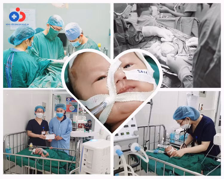 26 ngày tuổi đã xuất huyết não: Bệnh viện thuyết phục bố mẹ để cứu trẻ ảnh 1