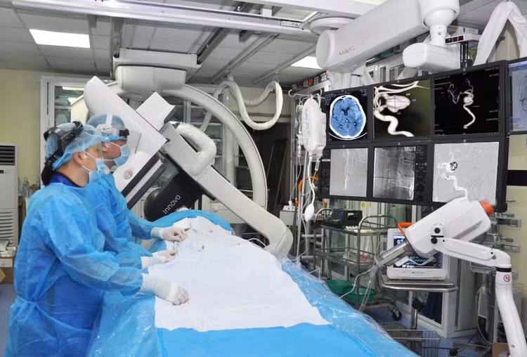 Một ca can thiệp mạch máu não. Nguồn: BV Quân y 103. - Ảnh BVCC