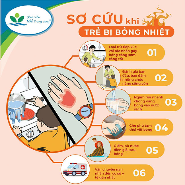 Cách xử trí bỏng đúng để tránh di chứng ảnh 1