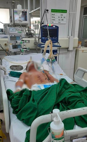 Cụ ông nguy kịch vì chảy máu dạ dày suy đa tạng và nhiều bệnh nền nặng - Ảnh BVCC