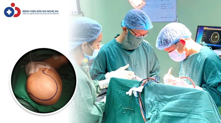 Ca phẫu thuật cho trẻ 18 tháng ngã cầu thang chấn thương sọ não nặng - Ảnh BVCC