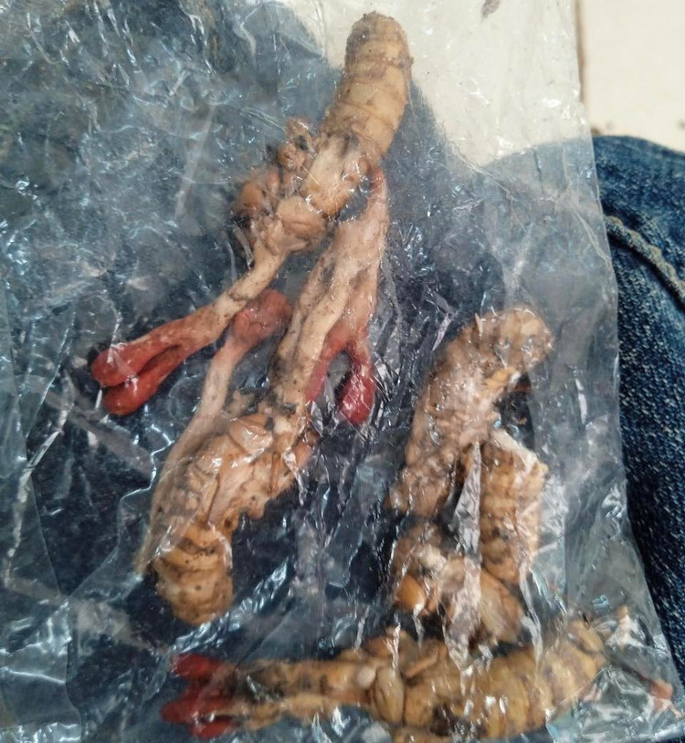 Xác nhộng ve sầu bệnh nhân nhầm tưởng là đông trùng hạ thảo - Ảnh: BVCC