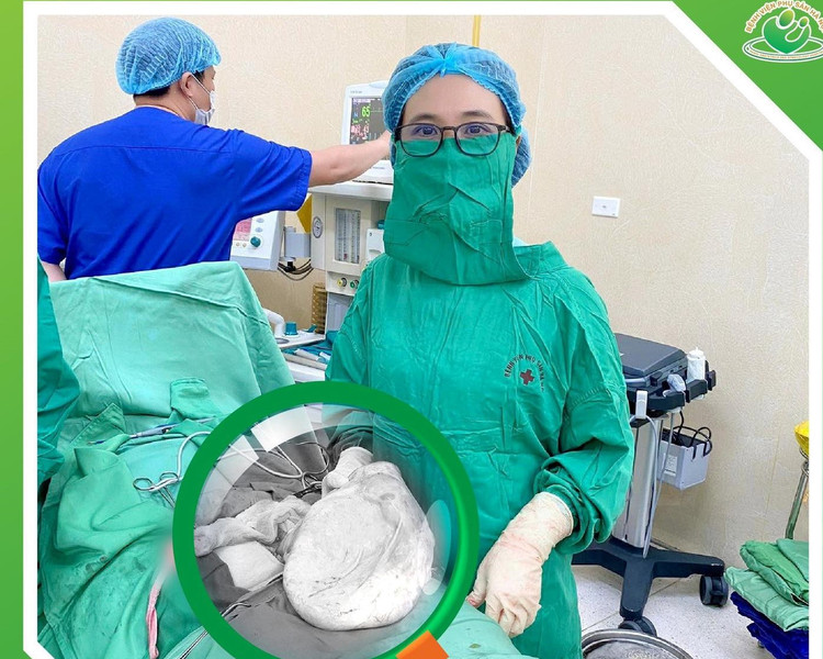 U nhầy buồng trứng nặng 8 kg ảnh 1