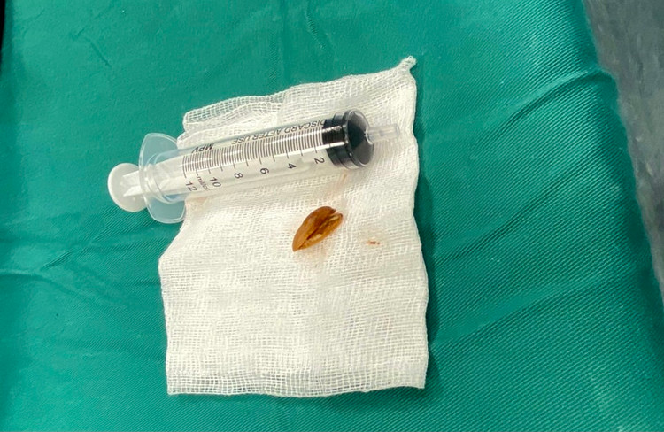 Vỏ hạt hướng dương được lấy ra