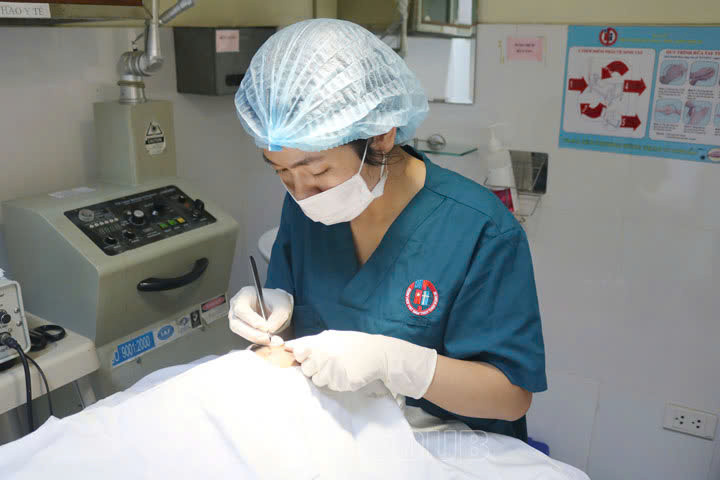 Phẫu thuật tẩy nốt ruồi cho bệnh nhi - Ảnh BVCC