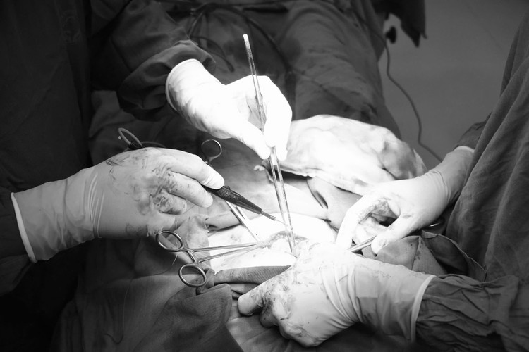 Ca phẫu thuật khối u buồng trứng cho bệnh nhân - Ảnh BVCC