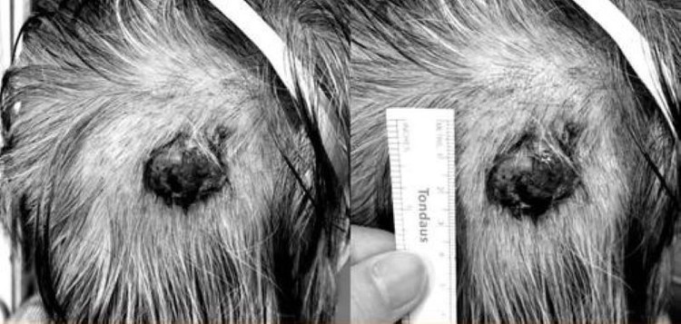 Khối u tuyến mồ hôi trên đầu bệnh nhân - Ảnh BVCC