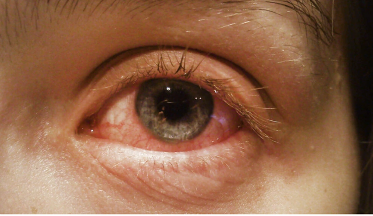 Những thay đổi ở mắt bất thường khi mang thai cần khám ngay ảnh 1