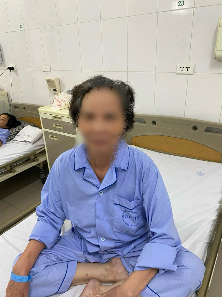 Bị sỏi túi mật không điều trị cụ bà 75 tuổi bị hội chứng Mirizzi