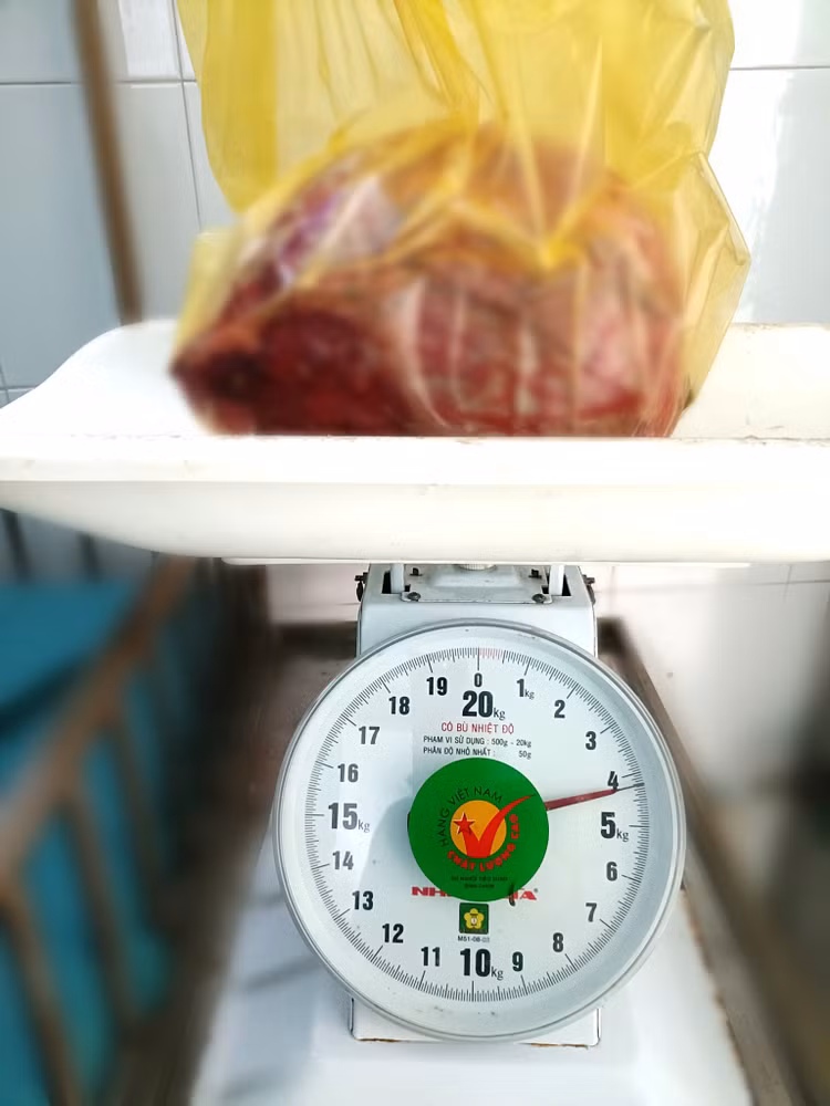Khối u nặng hơn 4kg được cắt bỏ