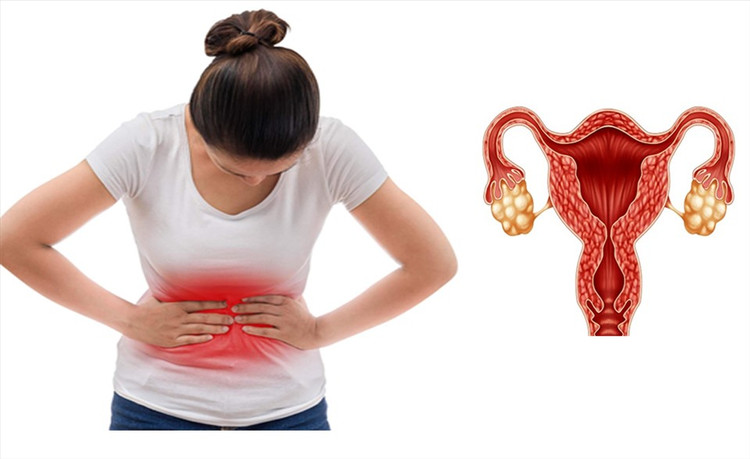 Cân nhắc Metformin đơn trị cho những trẻ gái vị thành niên bị PCOS nhằm điều hòa kinh nguyệt, dù bằng chứng còn hạn chế.