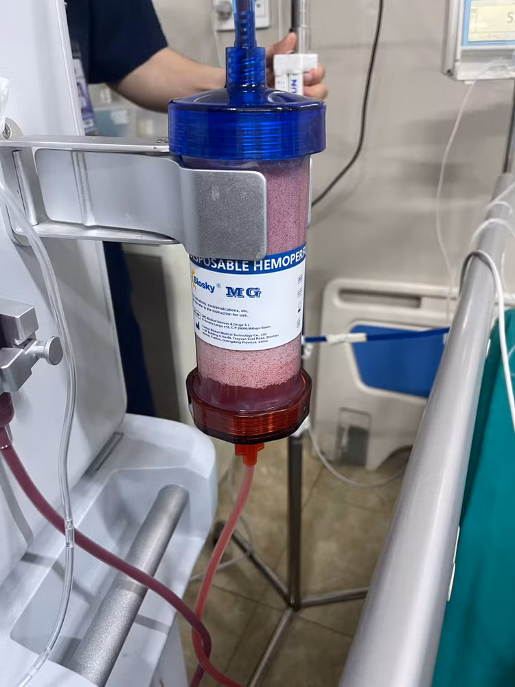 Lọc máu cho bệnh nhân viêm tụy cấp máu trắng như sữa