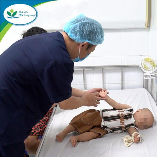 TS.BS Nguyễn Văn Lâm – Giám đốc Trung tâm Bệnh nhiệt đới, Bệnh viện Nhi Trung ương đang thăm khám cho trẻ mắc Tay Chân Miệng