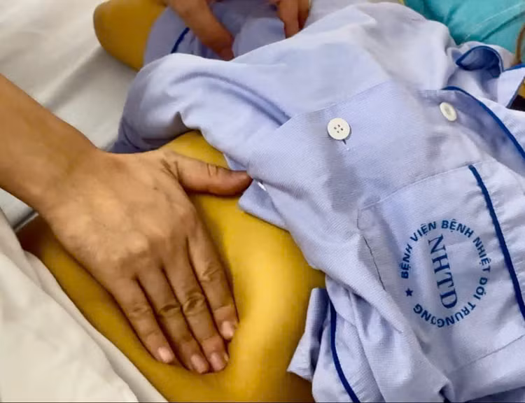 Biểu hiện vàng da như dát vàng - Ảnh BVCC