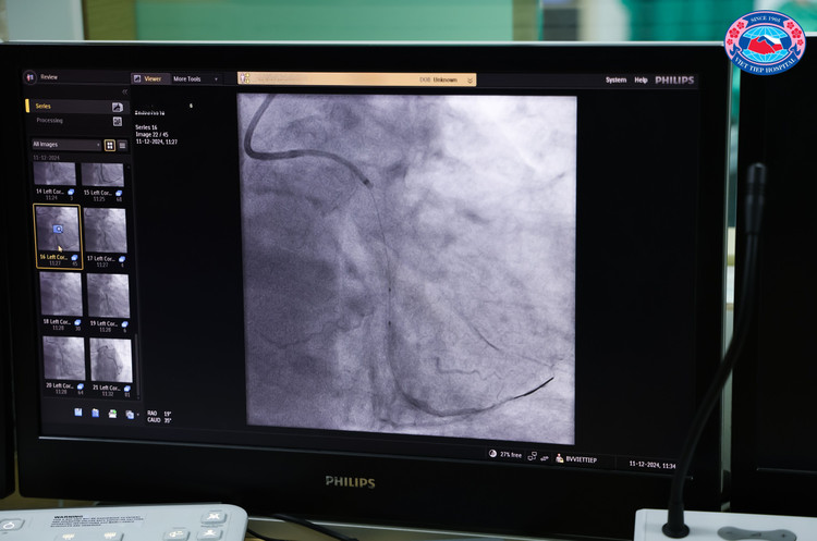 Tổn thương của bệnh nhân trên phim chụp - Ảnh BVCC