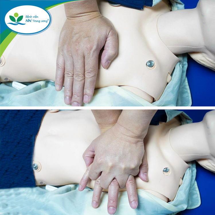 Cách hồi sức tim phổi do đuối nước