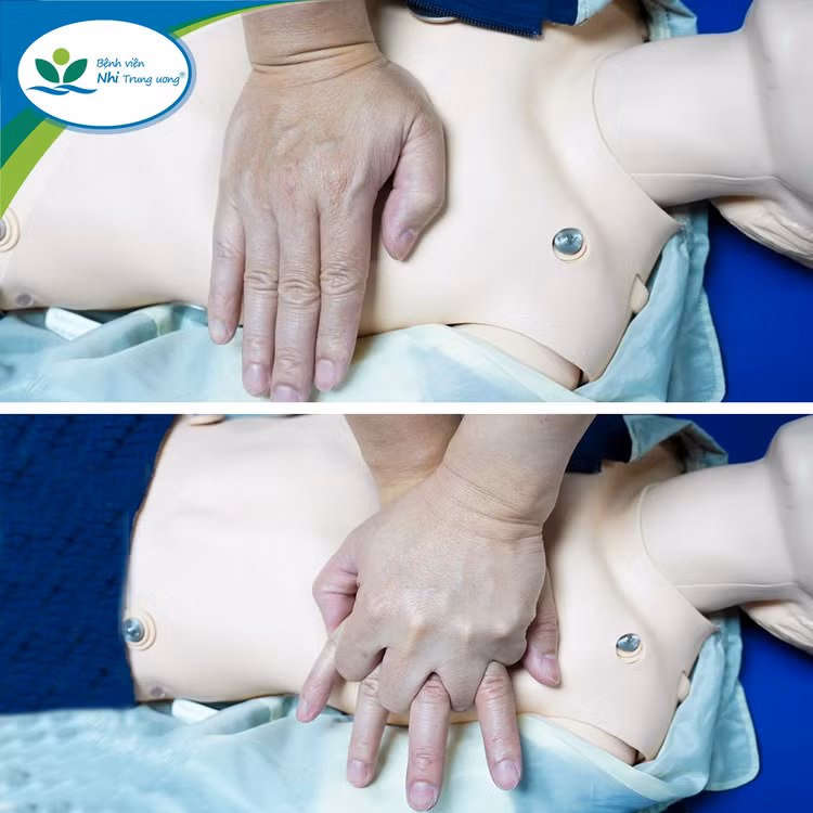 Cách hồi sức tim phổi do đuối nước