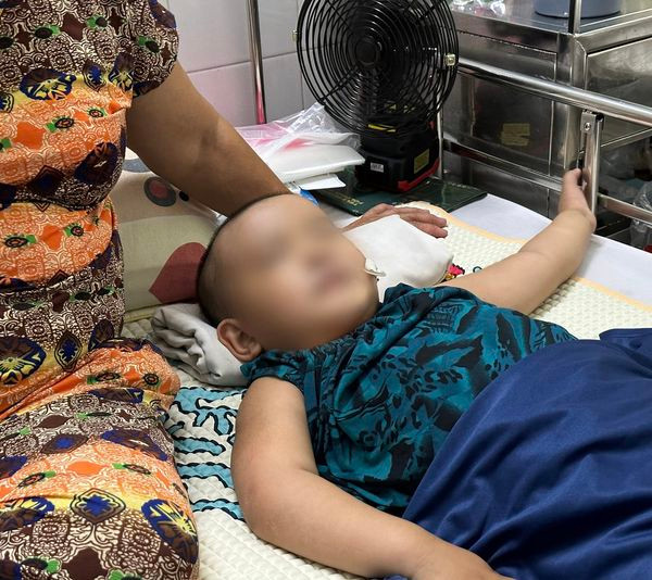 Trẻ viêm não hiếm gặp điều trị tại bệnh viện Nhi Đồng 2 Trẻ viêm não hiếm gặp điều trị tại bệnh viện Nhi Đồng 2