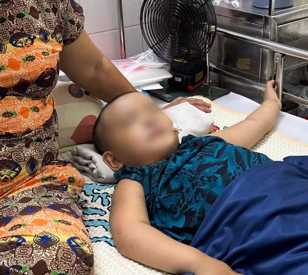 Trẻ viêm não hiếm gặp điều trị tại bệnh viện Nhi Đồng 2