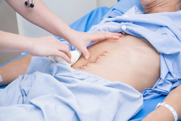 Chăm sóc vết mổ cho bệnh nhân - Ảnh BVCC