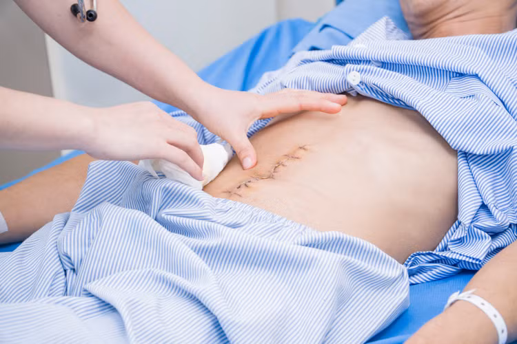 Chăm sóc vết mổ cho bệnh nhân - Ảnh BVCC Chăm sóc vết mổ cho bệnh nhân - Ảnh BVCC