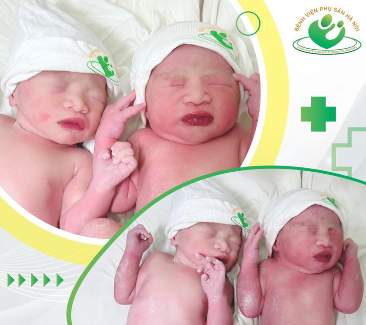 Hai trẻ sinh đôi tại bệnh viện Phụ sản Hà Nội - Ảnh BVCC