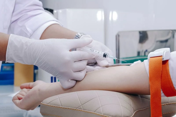 Có nên xét nghiệm D-dimer sàng lọc cục máu đông? ảnh 1