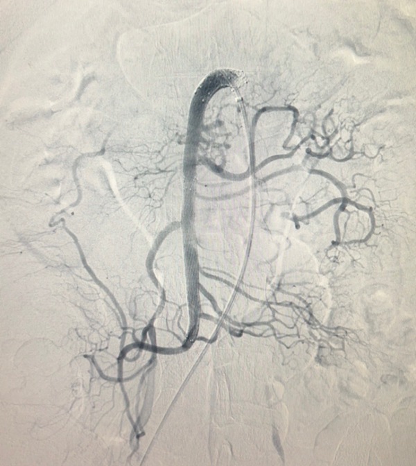Cứu sống người đàn ông mắc bệnh rất hiếm gặp ảnh 4