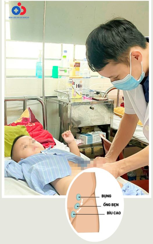 Thăm khám cho bệnh nhân sau phẫu thuật - Ảnh BVCC Thăm khám cho bệnh nhân sau phẫu thuật - Ảnh BVCC