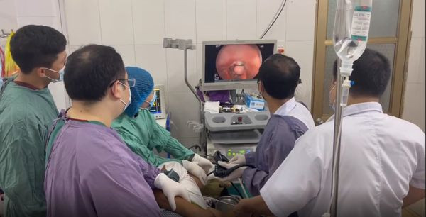 Can thiệp thắt tĩnh mạch thực quản cho bệnh nhân - Ảnh BVCC
