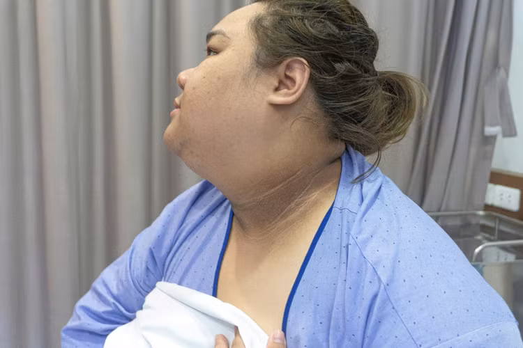 Biểu hiện ngoài da của bệnh gai đen - ảnh BSCC