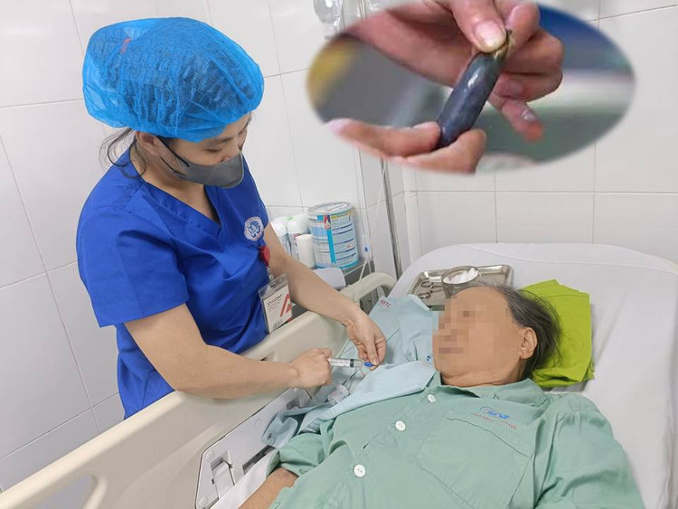 Dùng mật cá trôi bồi bổ, cụ bà nguy kịch ảnh 1