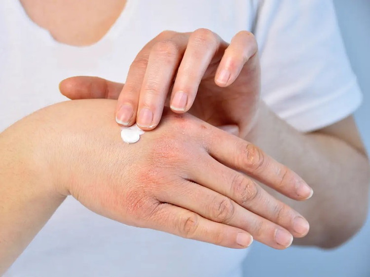 Khi chọn kem dưỡng ẩm cho mặt và cơ thể, hãy chọn loại lành tính nhất có thể. (Ảnh: ITN) Khi chọn kem dưỡng ẩm cho mặt và cơ thể, hãy chọn loại lành tính nhất có thể. (Ảnh: ITN)