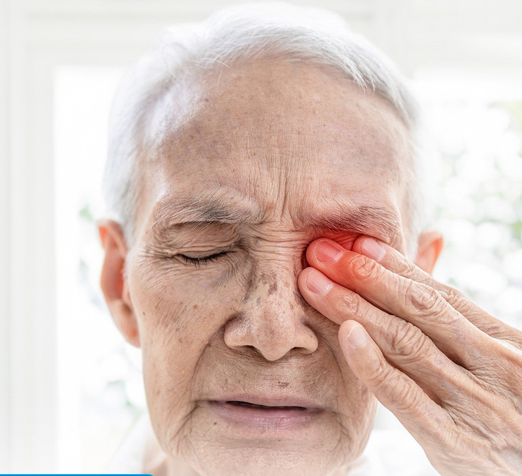 Múc bỏ cả con mắt do zona thần kinh tấn công, cách gì phòng ngừa - Ảnh BVCC