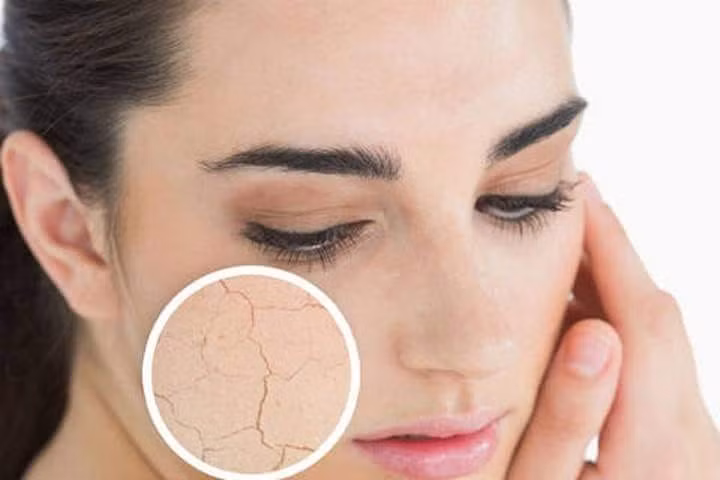 Lão hóa da - Ảnh minh họa