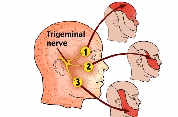 Hình ảnh dây thần kinh 5 - Ảnh BVCC